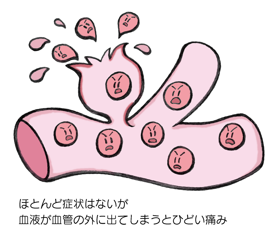 ほとんど症状はないが血液が血管の外に出てしまうとひどい痛み